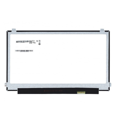 B156ZAN02.1 boyutu 15.6 inç 16.7M 60Hz AUO için LCD Moudle